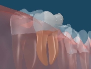 歯のイメージ図