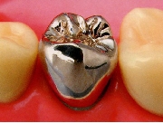 保険適用での治療例