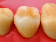 自費治療のイメージ図