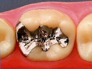 保険適用での治療例